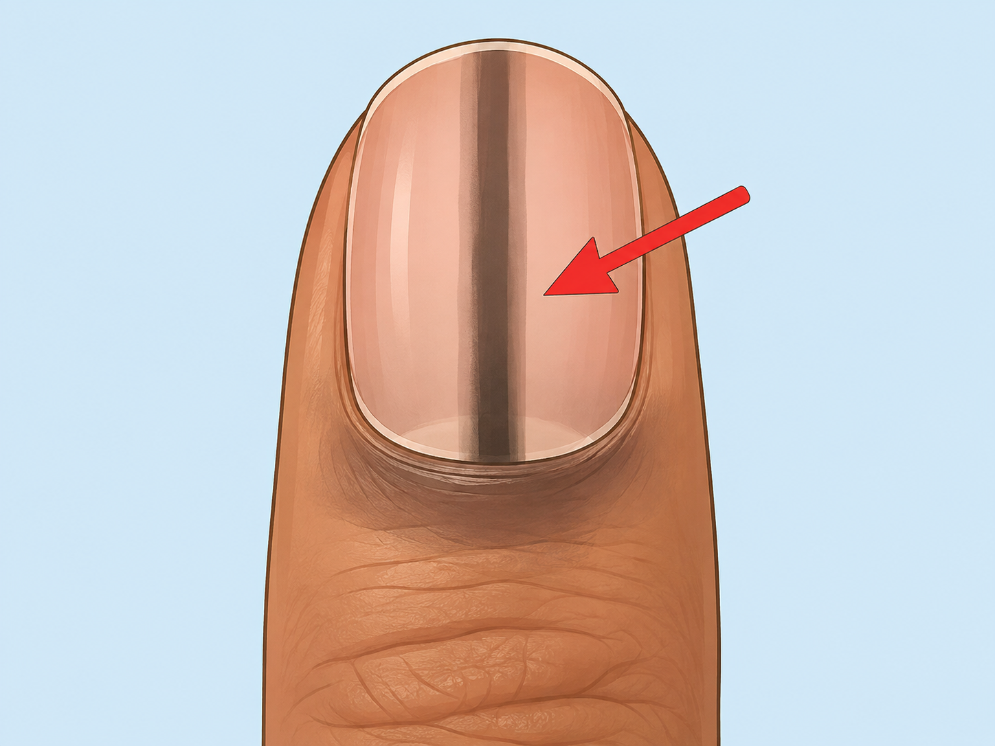 Close-up of a fingernail with a dark streak being checked.